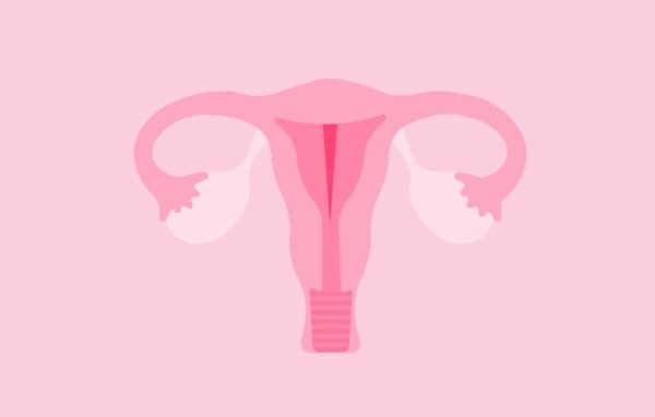 imagem mostrando um útero com uma divisão no seu interior representando o septo uterino